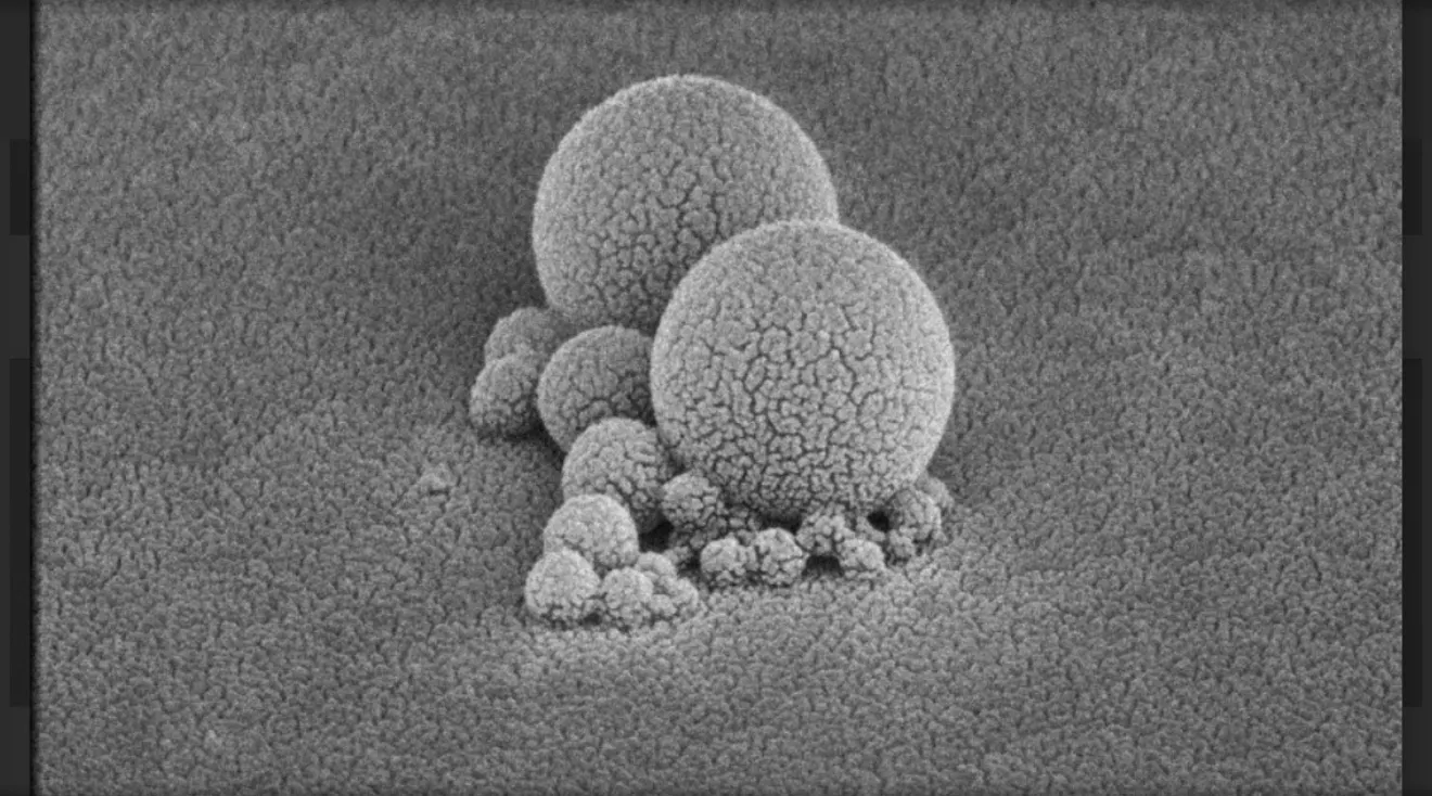 Monochrome electron-microscopy image of clustered spherical nanoscale forms.