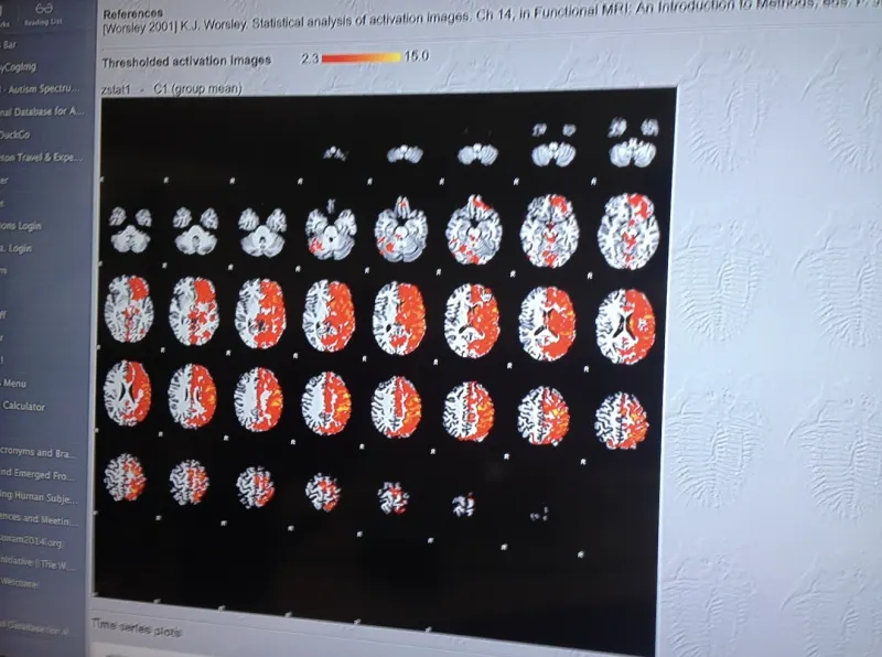 Computer display showing thresholded brain-activation maps and analysis controls.