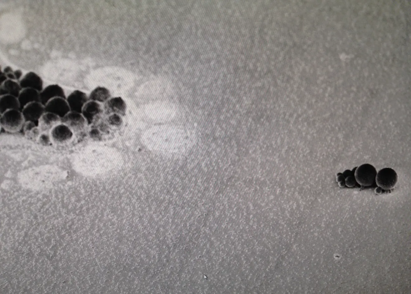 High-magnification monochrome microscopy image with clustered rounded forms.